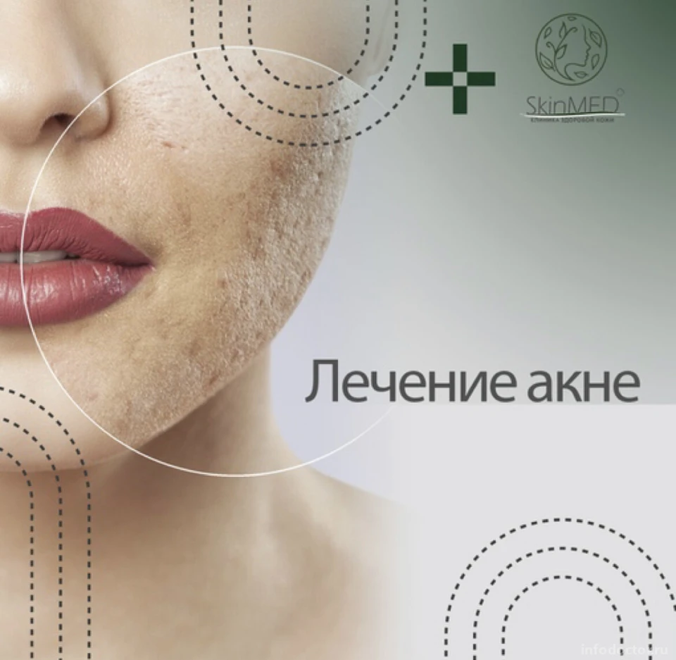 Клиника здоровой кожи SkinMed: запись на прием, телефон, адрес, отзывы цены  и скидки на InfoDoctor.ru